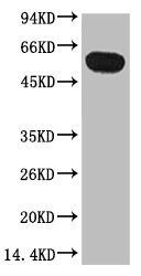 TUBB1 Antibody