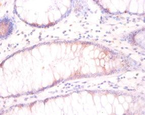 TUBB3 Antibody