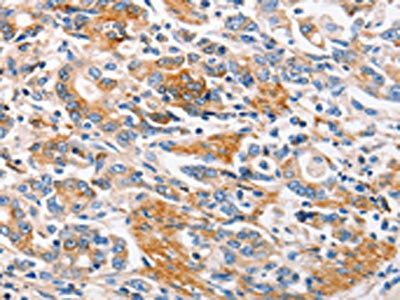 MC1R Antibody