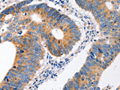 MC1R Antibody