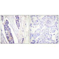 TUBB3 Antibody
