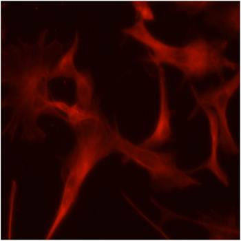 TUBA4A Antibody