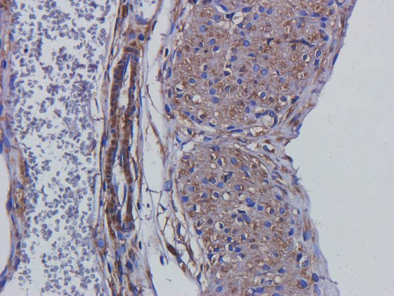 Tubulin beta 3 antibody