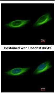 TULP1 Rabbit Polyclonal Antibody