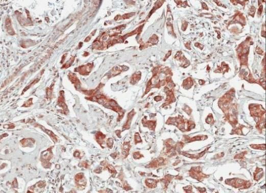 TULP1 Rabbit Polyclonal Antibody