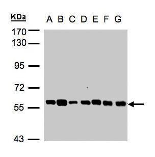 TULP1 Rabbit Polyclonal Antibody