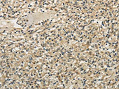 TULP2 Antibody