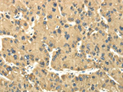 TULP2 Antibody