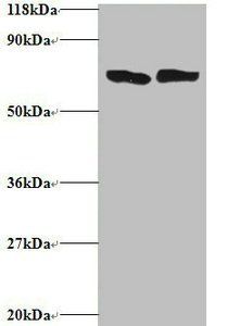 TNF Antibody