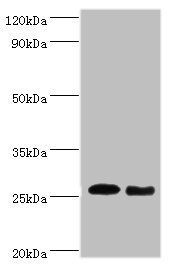 TNF Antibody