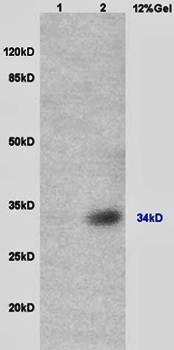 TUSC3 Rabbit Polyclonal Antibody