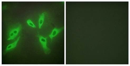 TUSC3 Antibody