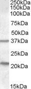 TUSC3/N33 Antibody