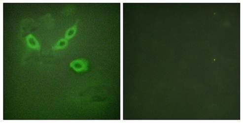 TUSC5 Antibody