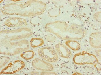 TWIST2 Antibody