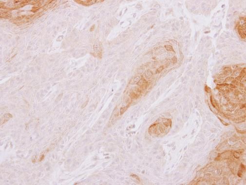 TXNDC3 Rabbit Polyclonal Antibody