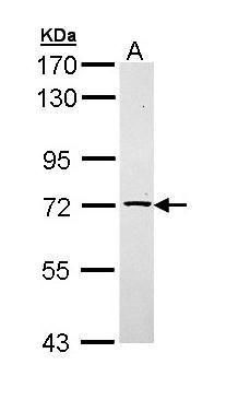 TXNDC3 Rabbit Polyclonal Antibody