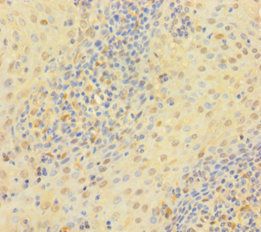 TYMP Antibody