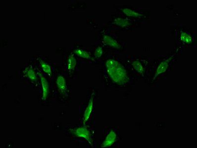 TYMS Antibody