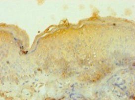 TYR Antibody