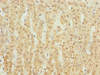 UBASH3B Antibody
