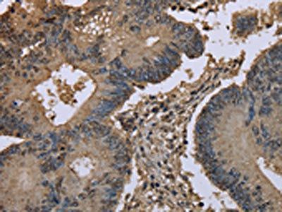 UBB Antibody