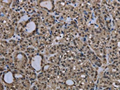 UBB Antibody