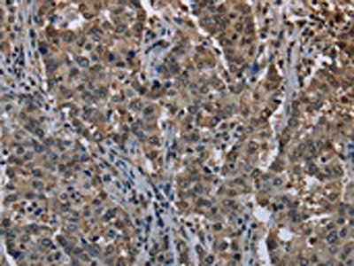 UBB Antibody