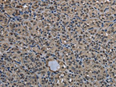 UBB Antibody