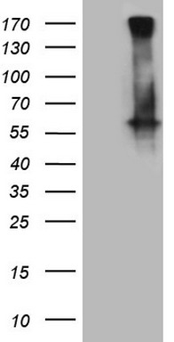 UBE2B Antibody