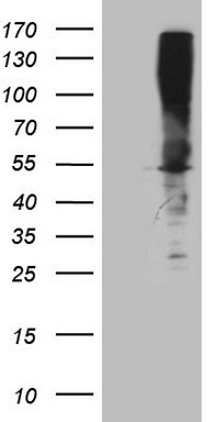 UBE2D2 Antibody