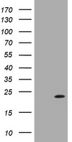 UBE2E3 Antibody