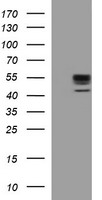 UBE2G2 Antibody