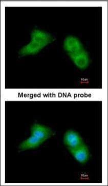 UBE2G2 Rabbit Polyclonal Antibody