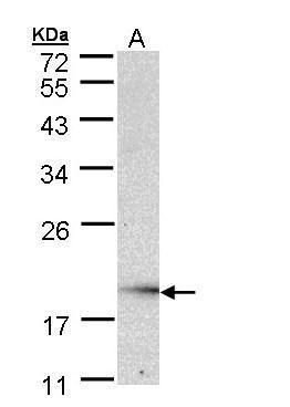 UBE2G2 Rabbit Polyclonal Antibody