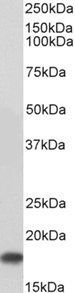 UBE2I Antibody