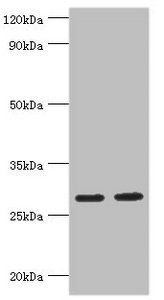 UBE2J2 Antibody
