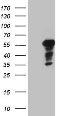 UBE3B Antibody