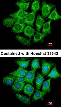 UBE4B antibody