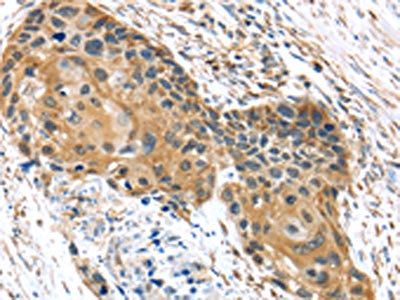 UBTD1 Antibody