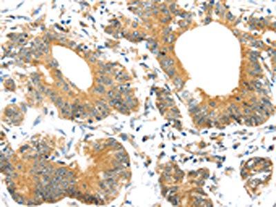 UBTD1 Antibody