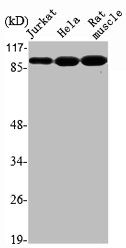 UBTF Antibody
