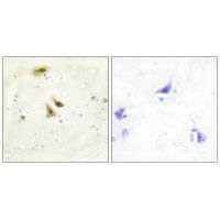 UBTF Antibody