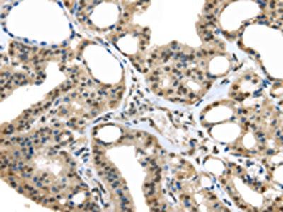UCHL3 Antibody