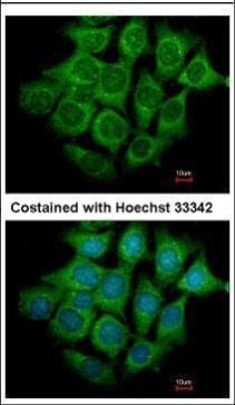UBE4B Rabbit Polyclonal Antibody