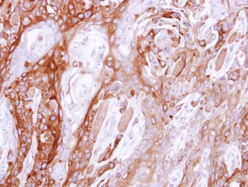 UBE4B Rabbit Polyclonal Antibody