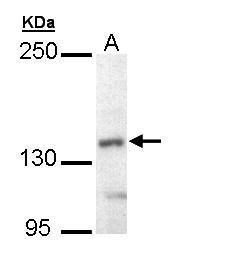 UBE4B Rabbit Polyclonal Antibody