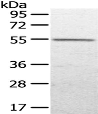 UGP2 Antibody