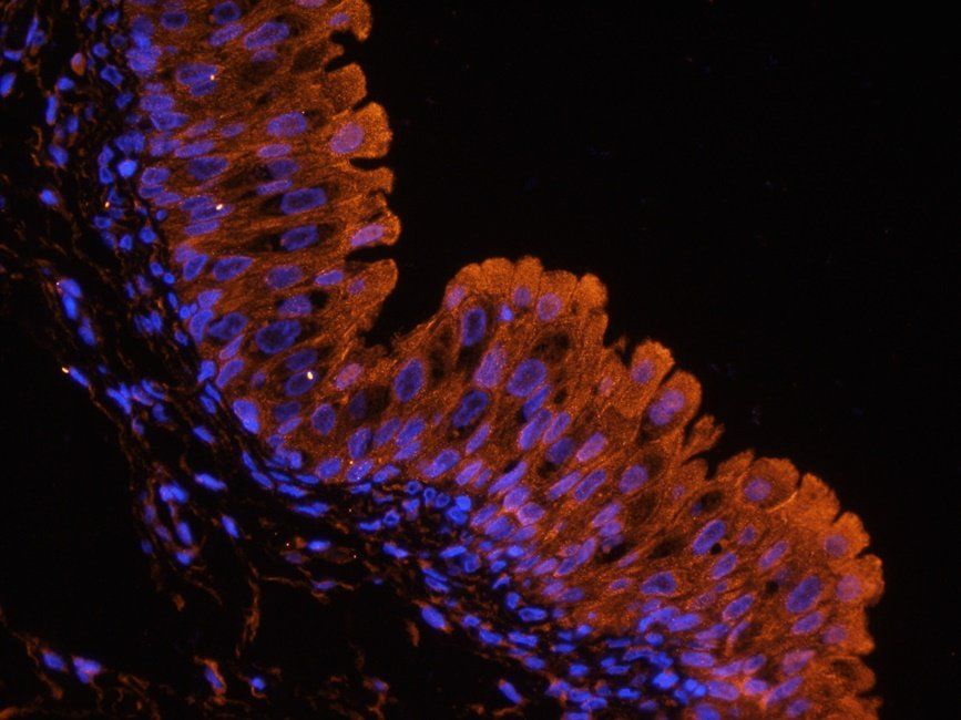 UGT1A1 antibody