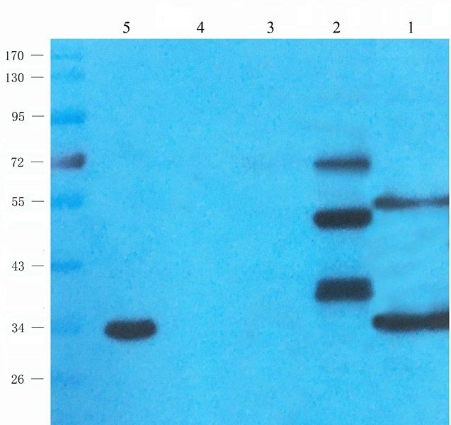 UGT1A1 antibody